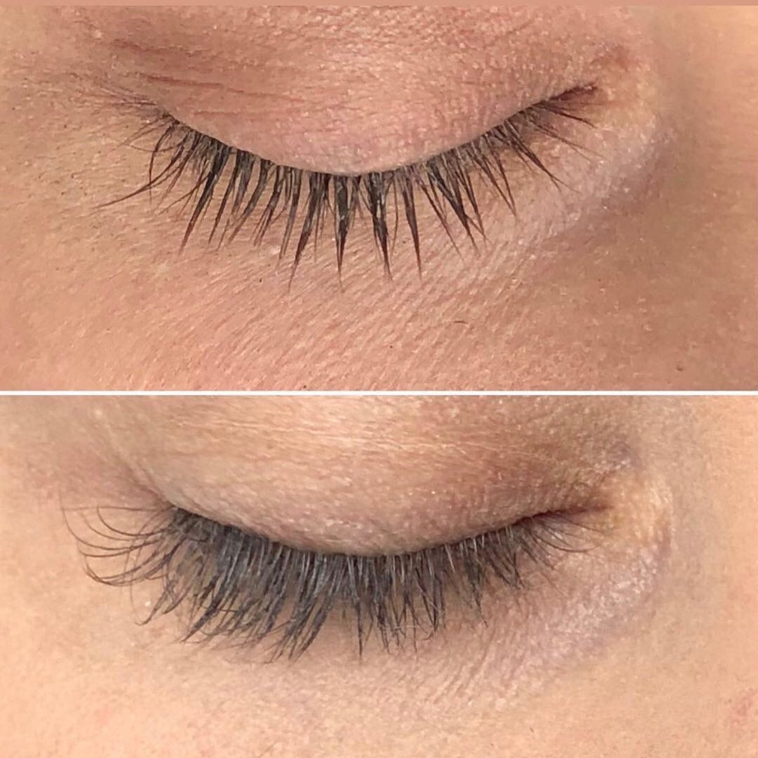 Before and after shot of using Lash Serum